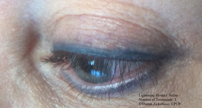 camouflage eyeliner after saline lightening.jpg
